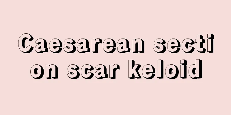 Caesarean section scar keloid