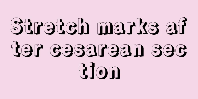 Stretch marks after cesarean section