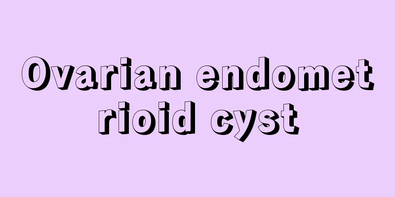 Ovarian endometrioid cyst