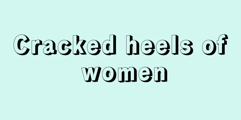 Cracked heels of women