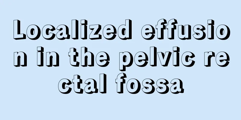 Localized effusion in the pelvic rectal fossa