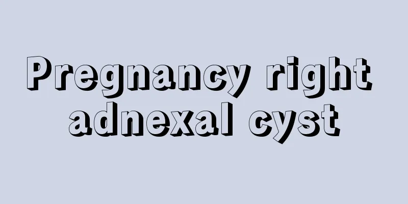 Pregnancy right adnexal cyst