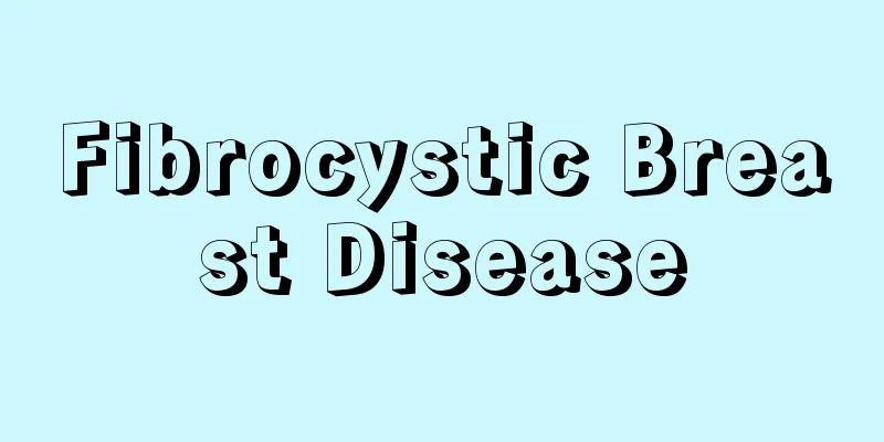 Fibrocystic Breast Disease