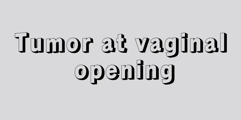 Tumor at vaginal opening