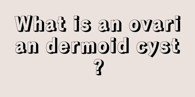 What is an ovarian dermoid cyst?