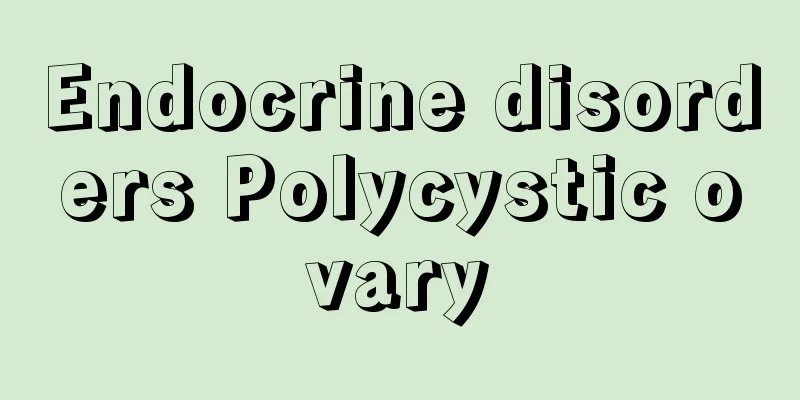 Endocrine disorders Polycystic ovary