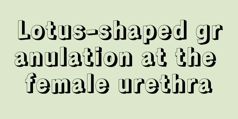 Lotus-shaped granulation at the female urethra