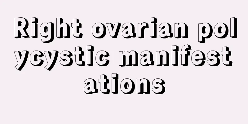 Right ovarian polycystic manifestations