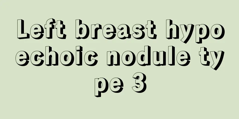 Left breast hypoechoic nodule type 3