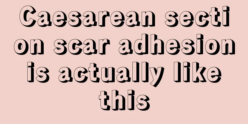 Caesarean section scar adhesion is actually like this