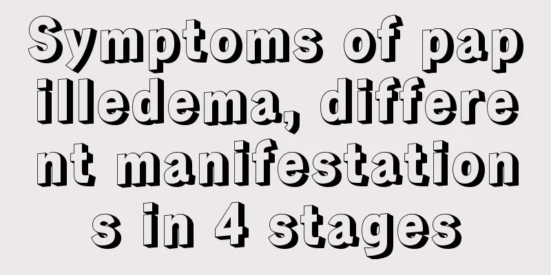 Symptoms of papilledema, different manifestations in 4 stages