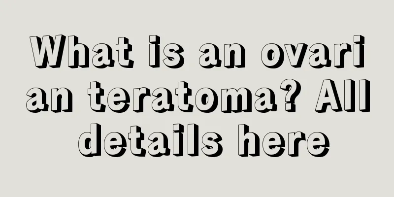 What is an ovarian teratoma? All details here