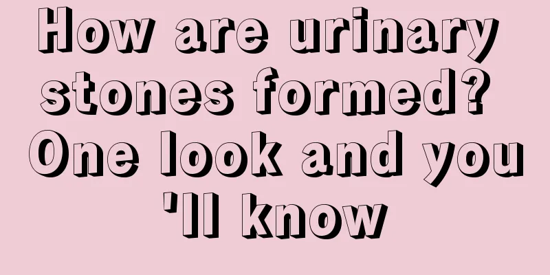 How are urinary stones formed? One look and you'll know