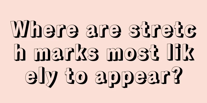 Where are stretch marks most likely to appear?