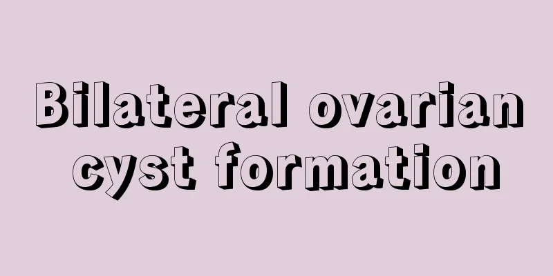 Bilateral ovarian cyst formation