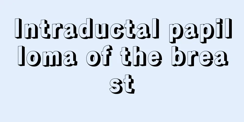 Intraductal papilloma of the breast