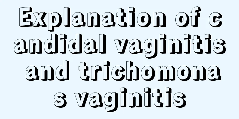 Explanation of candidal vaginitis and trichomonas vaginitis