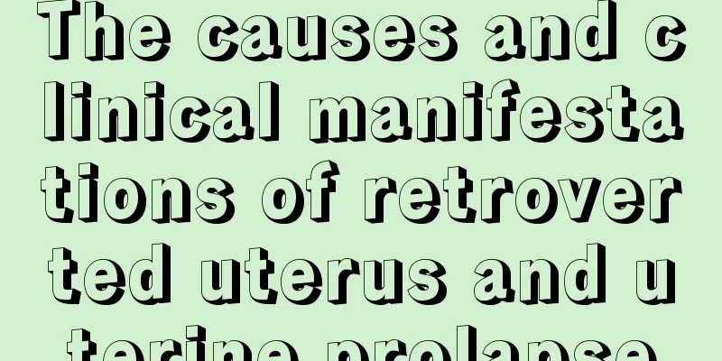 The causes and clinical manifestations of retroverted uterus and uterine prolapse