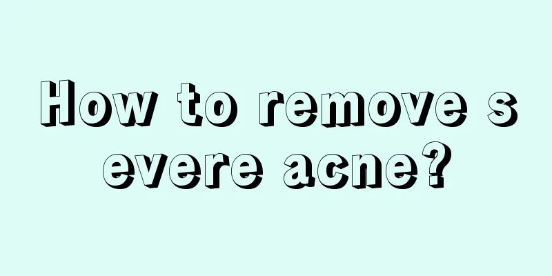 How to remove severe acne?