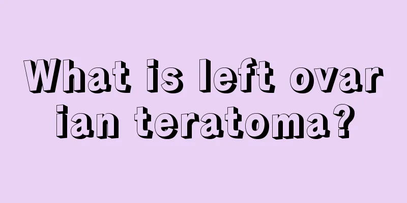 What is left ovarian teratoma?