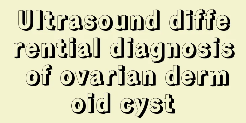 Ultrasound differential diagnosis of ovarian dermoid cyst