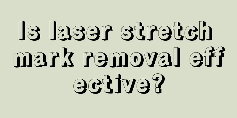 Is laser stretch mark removal effective?