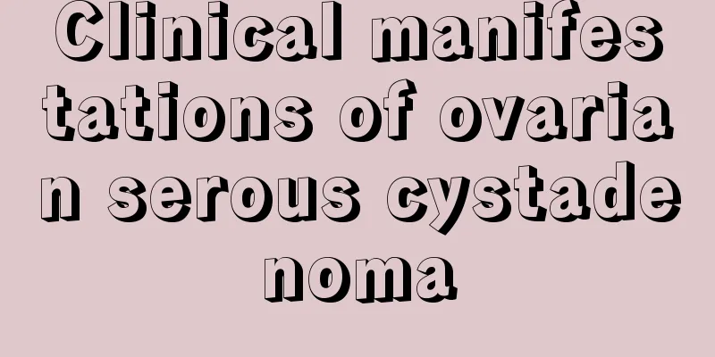 Clinical manifestations of ovarian serous cystadenoma