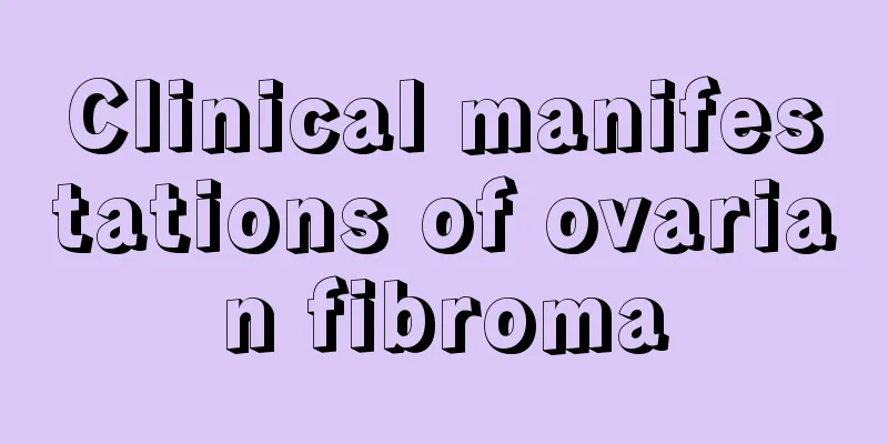 Clinical manifestations of ovarian fibroma