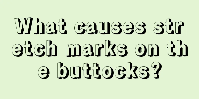 What causes stretch marks on the buttocks?