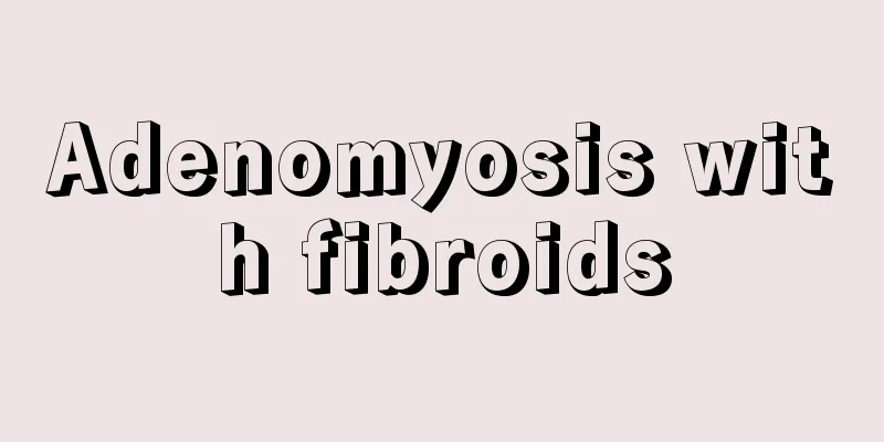 Adenomyosis with fibroids