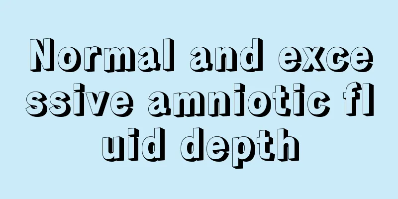 Normal and excessive amniotic fluid depth