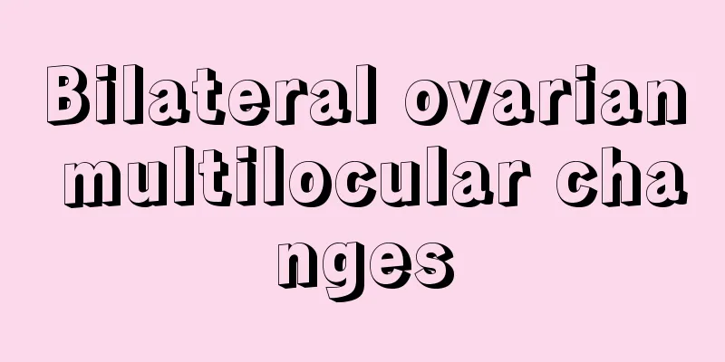 Bilateral ovarian multilocular changes