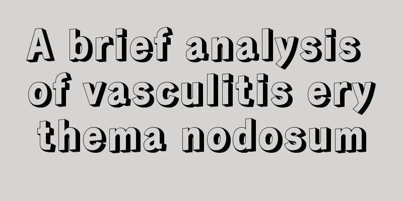 A brief analysis of vasculitis erythema nodosum