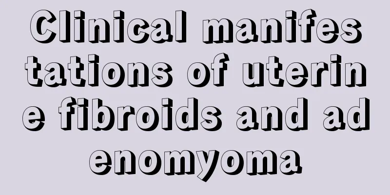 Clinical manifestations of uterine fibroids and adenomyoma