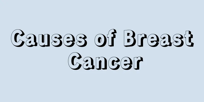 Causes of Breast Cancer