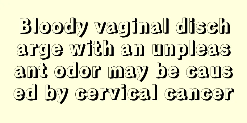 Bloody vaginal discharge with an unpleasant odor may be caused by cervical cancer