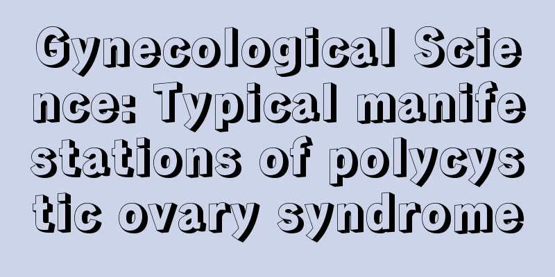 Gynecological Science: Typical manifestations of polycystic ovary syndrome