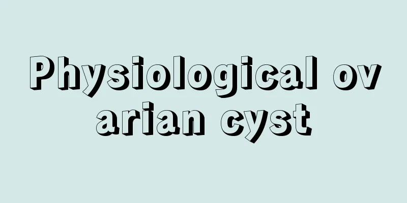 Physiological ovarian cyst