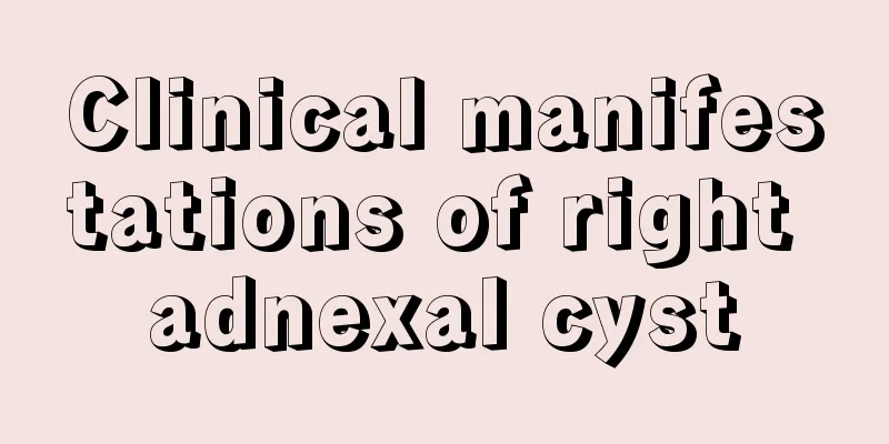 Clinical manifestations of right adnexal cyst