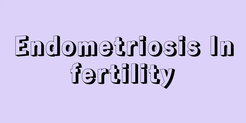 Endometriosis Infertility