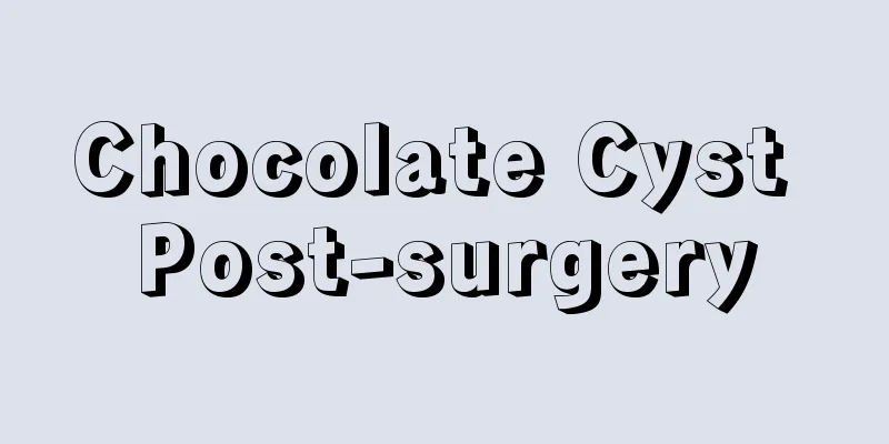 Chocolate Cyst Post-surgery