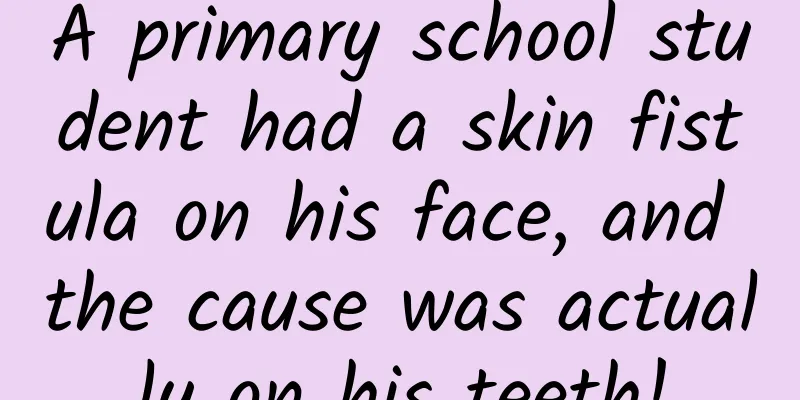 A primary school student had a skin fistula on his face, and the cause was actually on his teeth!