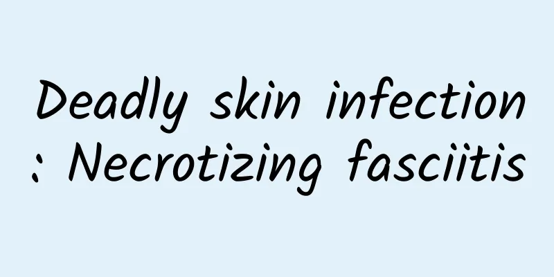 Deadly skin infection: Necrotizing fasciitis